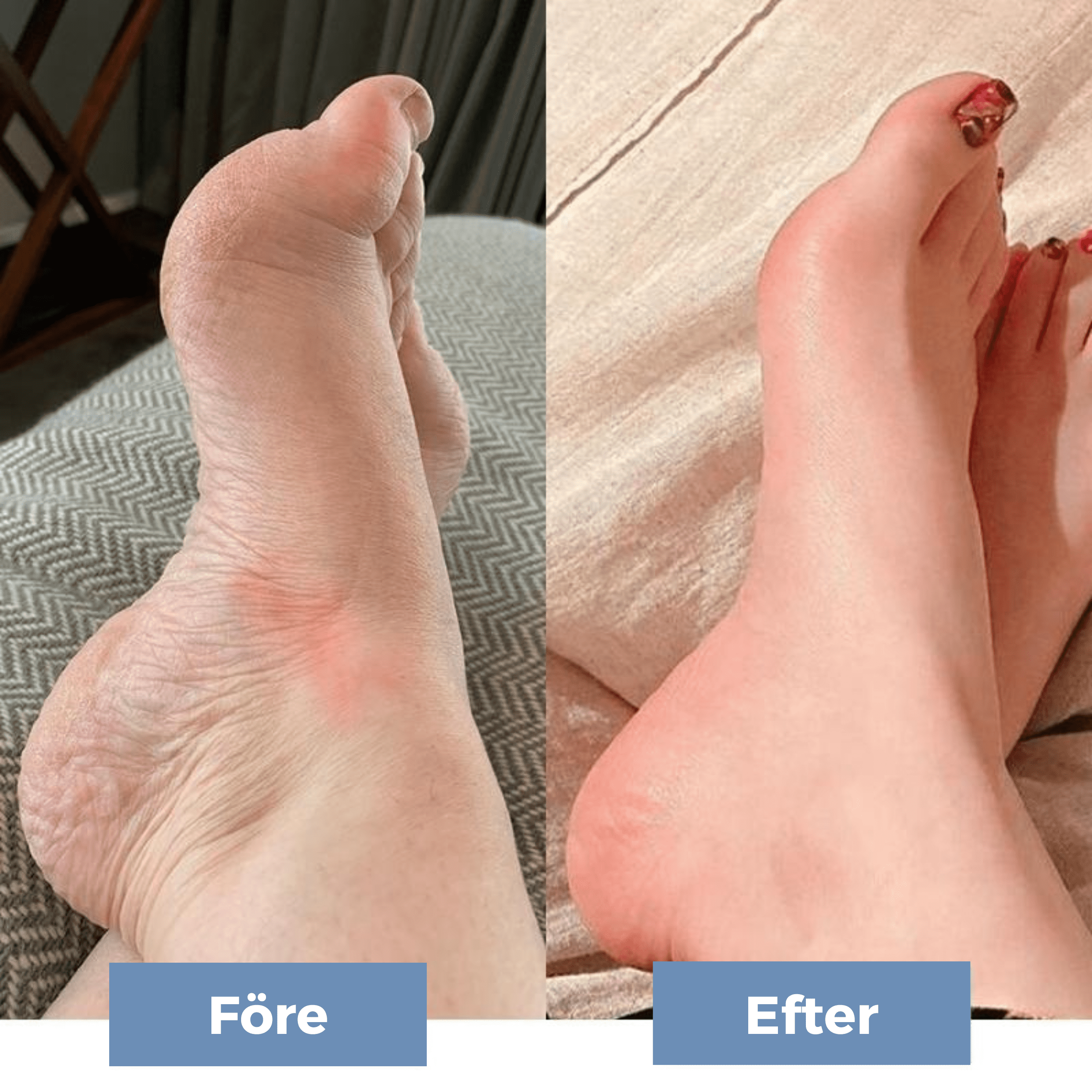 EMS FootRelaxer - Räddaren för dina fötter